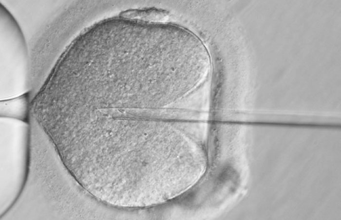 ASSISTED REPRODUCTION